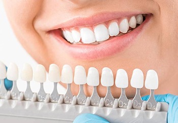 Dental crown color matching guide