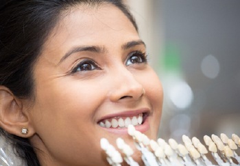 teeth veneer color match
