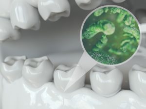 dental plaque illustration